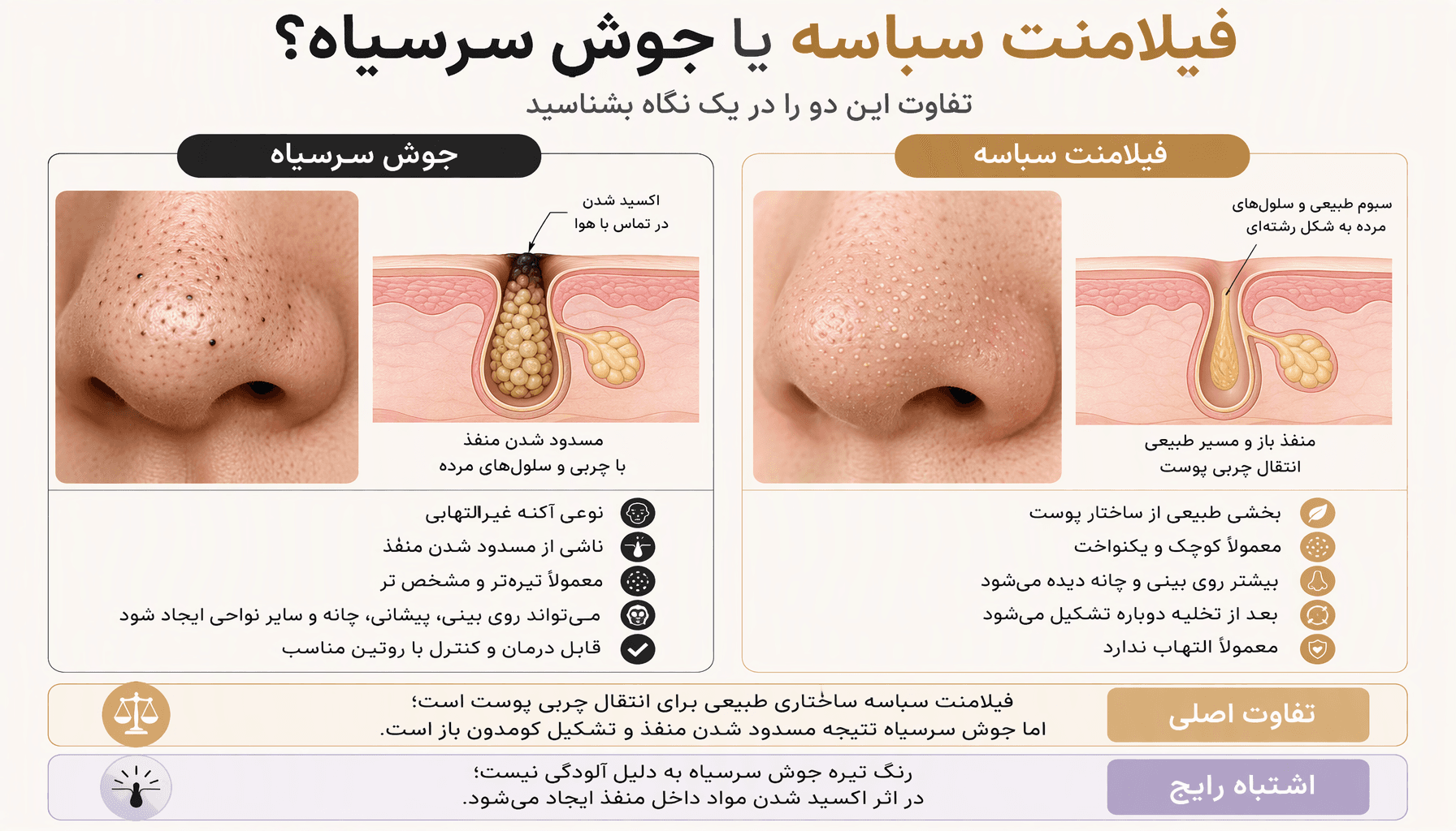 نمای نزدیک و طبیعی از بینی و پوست صورت یک فرد بزرگسال در نور ملایم روز، با بافت واقعی پوست و منافذ قابل مشاهده و بدون روتوش اغراقشده